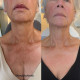 NECK LIFT CREAM. Інтенсивний анти-ейдж крем для шкіри шиї та декольте з 6-ма видами розчинного мікроколагену (колагенові нитки) і 22-ма активними інгредієнтами для клітинного омолодження, 50 гр