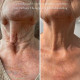 NECK LIFT CREAM. Інтенсивний анти-ейдж крем для шкіри шиї та декольте з 6-ма видами розчинного мікроколагену (колагенові нитки) і 22-ма активними інгредієнтами для клітинного омолодження, 50 гр